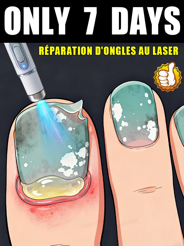 

Лазерное лечение ногтей и удаления онихомикоза