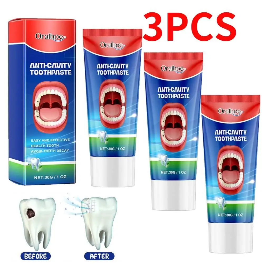 3pc Anti Decay Toothpaste Dental Caries Repair Cream Prevent Tooth Decay Toothpaste Remove Plaque Toothache Relieve Periodontiti