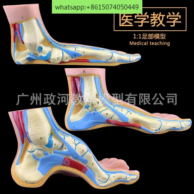 

Foot model normal foot flat foot arch anatomical model structure building muscle and blood vessel teaching medicine