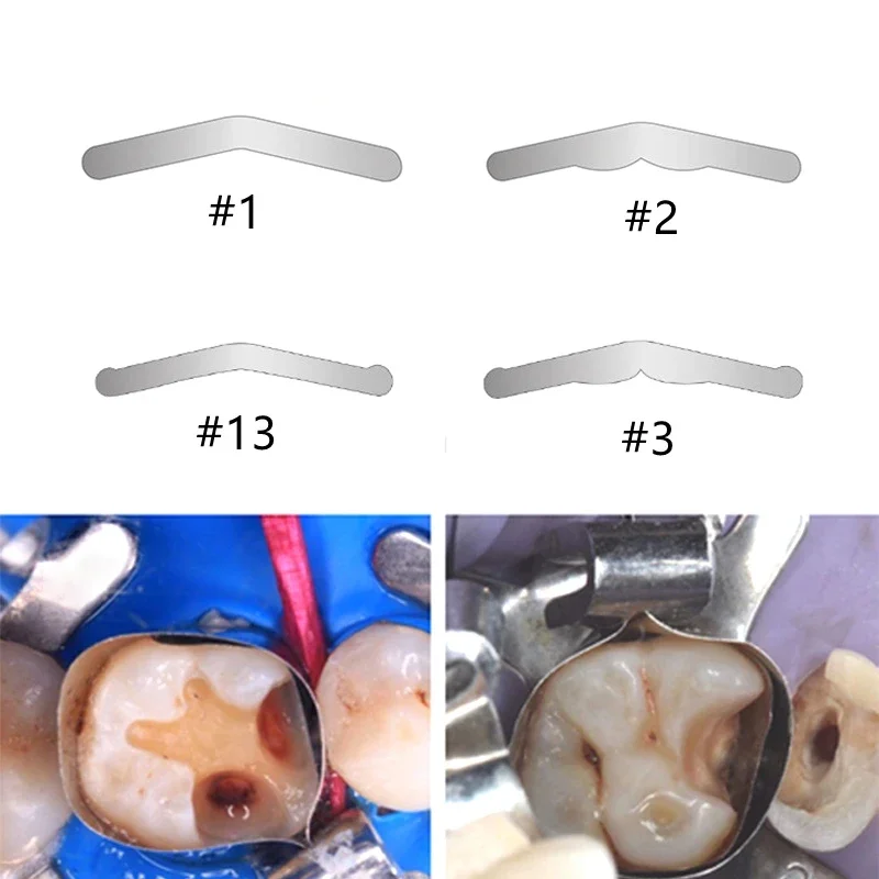 12pcs Dental Matrix Bands Margin Elevation Large Increased Curvature Sectional Contoured Matrices Dentistry Restoration Material
