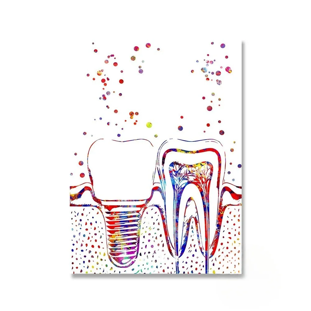 Orthodontic Implant Teeth Clinic Dental Medical Teeth Wall Art Picture Posters Canvas Paintings Room Decoration Home Decor