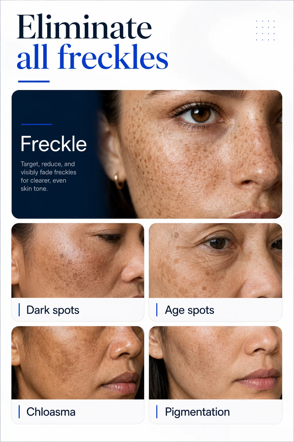 Dark Spot Appearance Care Cream for Face, Daily Skin Routine for Freckles, Melasma and Uneven-Looking Tone