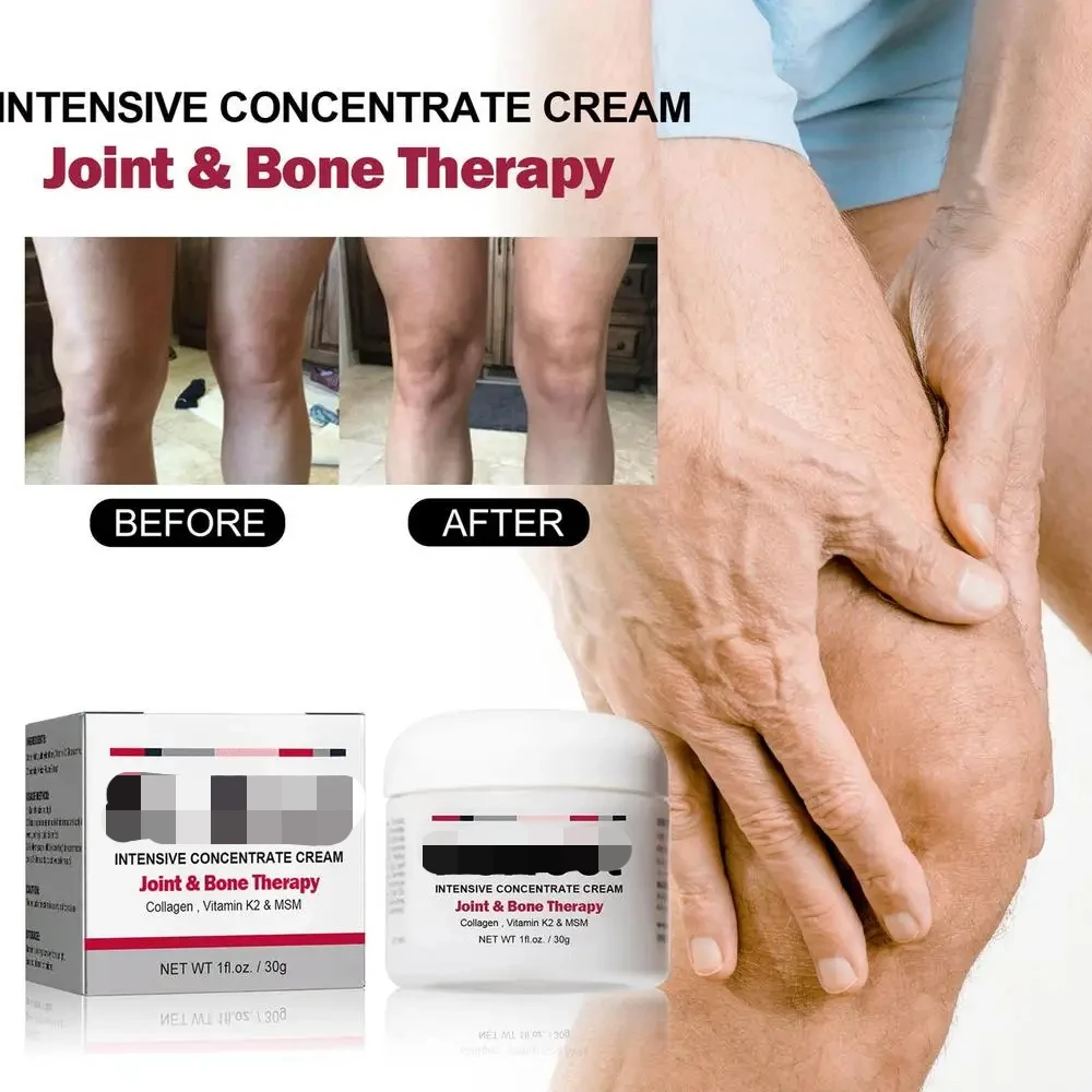 Advanced Joint and Cream Propolis Joint Cream Relief Cream Orthopedic Valgus Corrector Knee Muscle Treat Ointments 30g