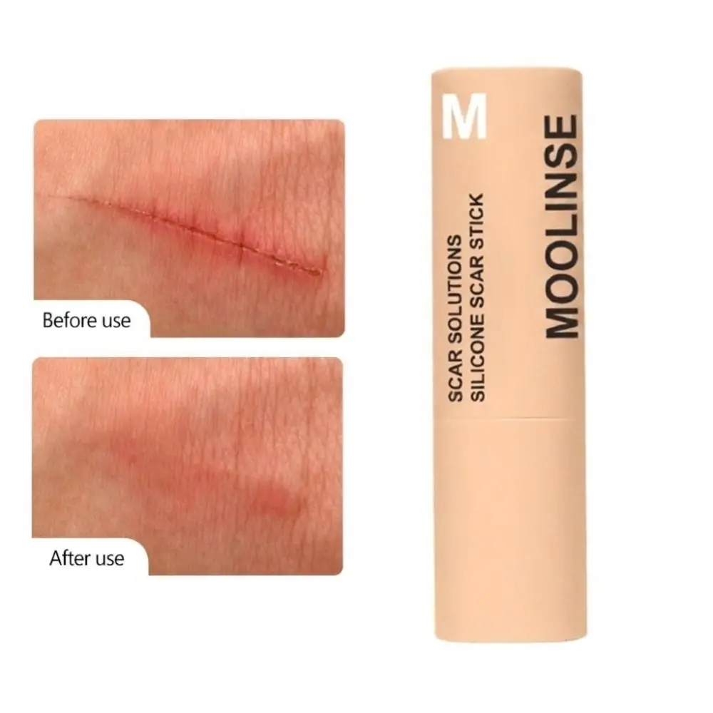 60% Silicone Silicone Scar Stick Thick Solid Velvety Film Scar Treatment Stick Soothing Formula Centella Asiatica Extracts