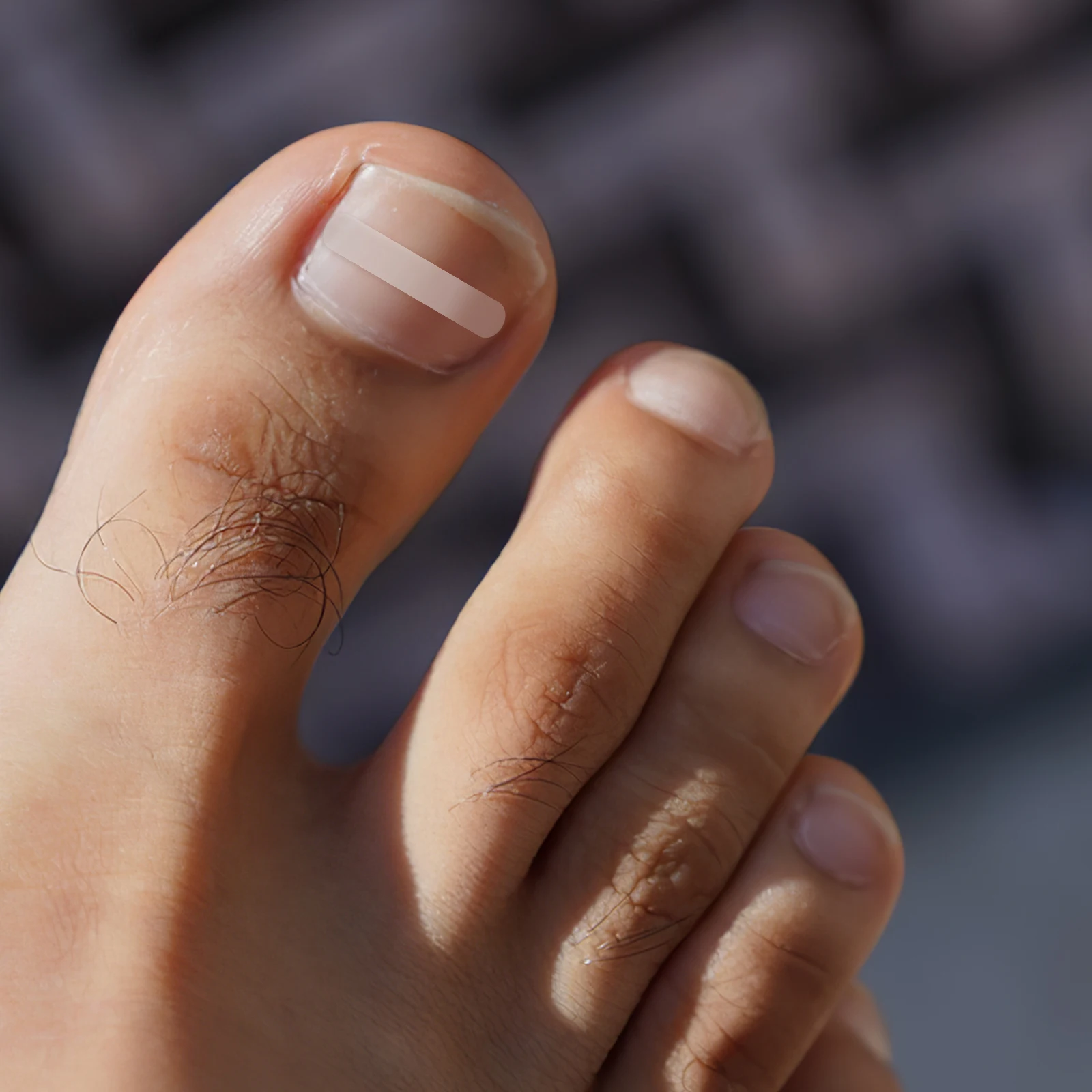 120개 발가락 교정 스티커 내성발톱 패치 네일 교정 보조기구 통증 완화 유연한 착용감 일상 착용 가능 투명