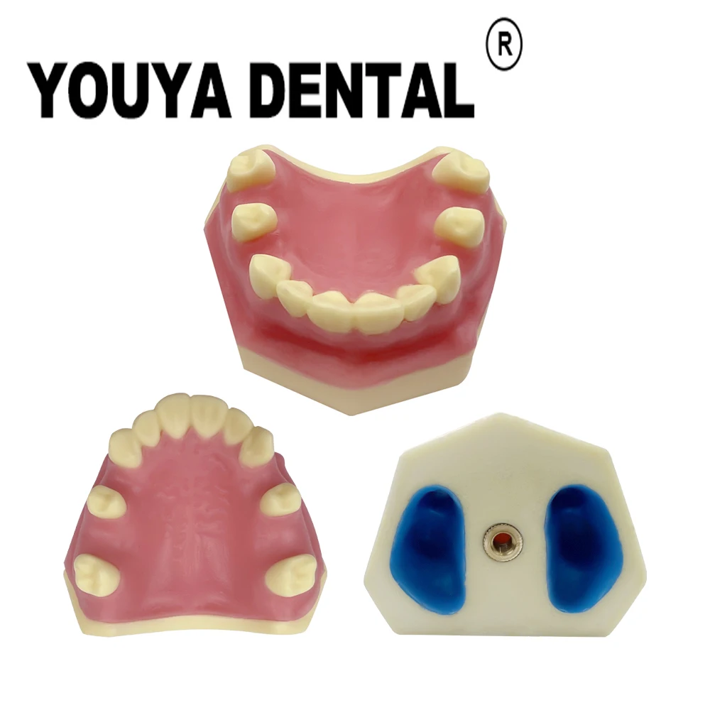 

Dental Mandibular Sinus Implant Practice Model with Soft Gum For Dental Technician Studying Training Teaching Model