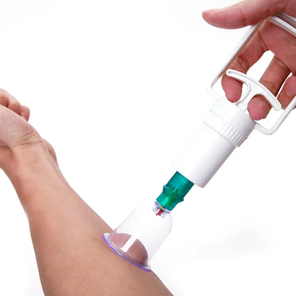 진공 부항 세트 의료용 플라스틱 바디 마사지 치료 장치 가정용 흡입 펌프 허리 통증 완화용