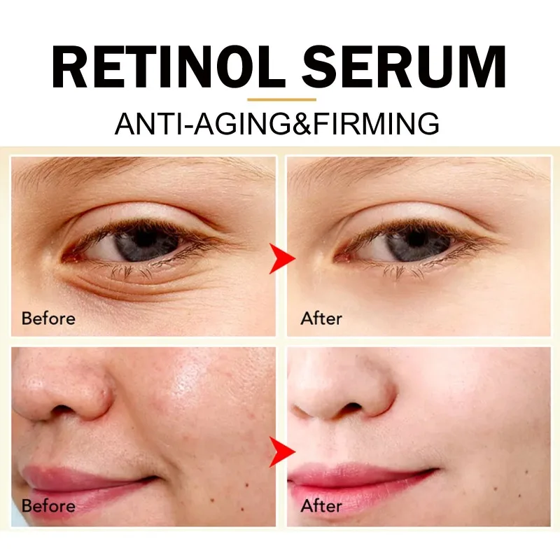 Retinol anti-wrinkle essence fade fine lines nasolabial folds remove Dullness firming moisturize brighten skin anti aging Serum