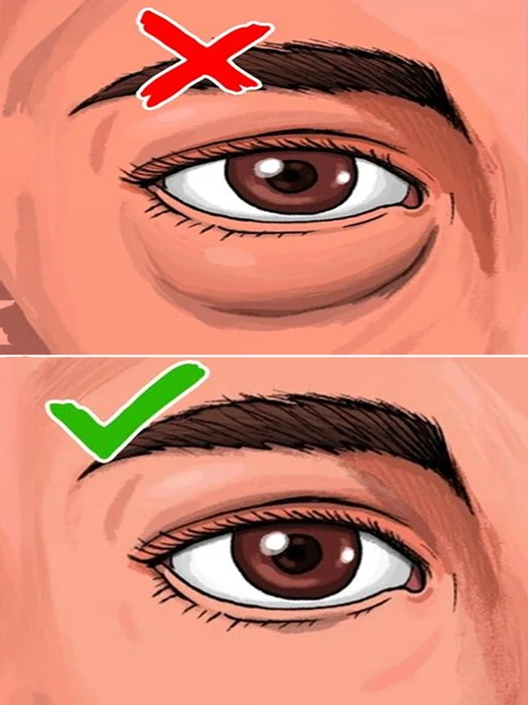 

Erase eye problems for you