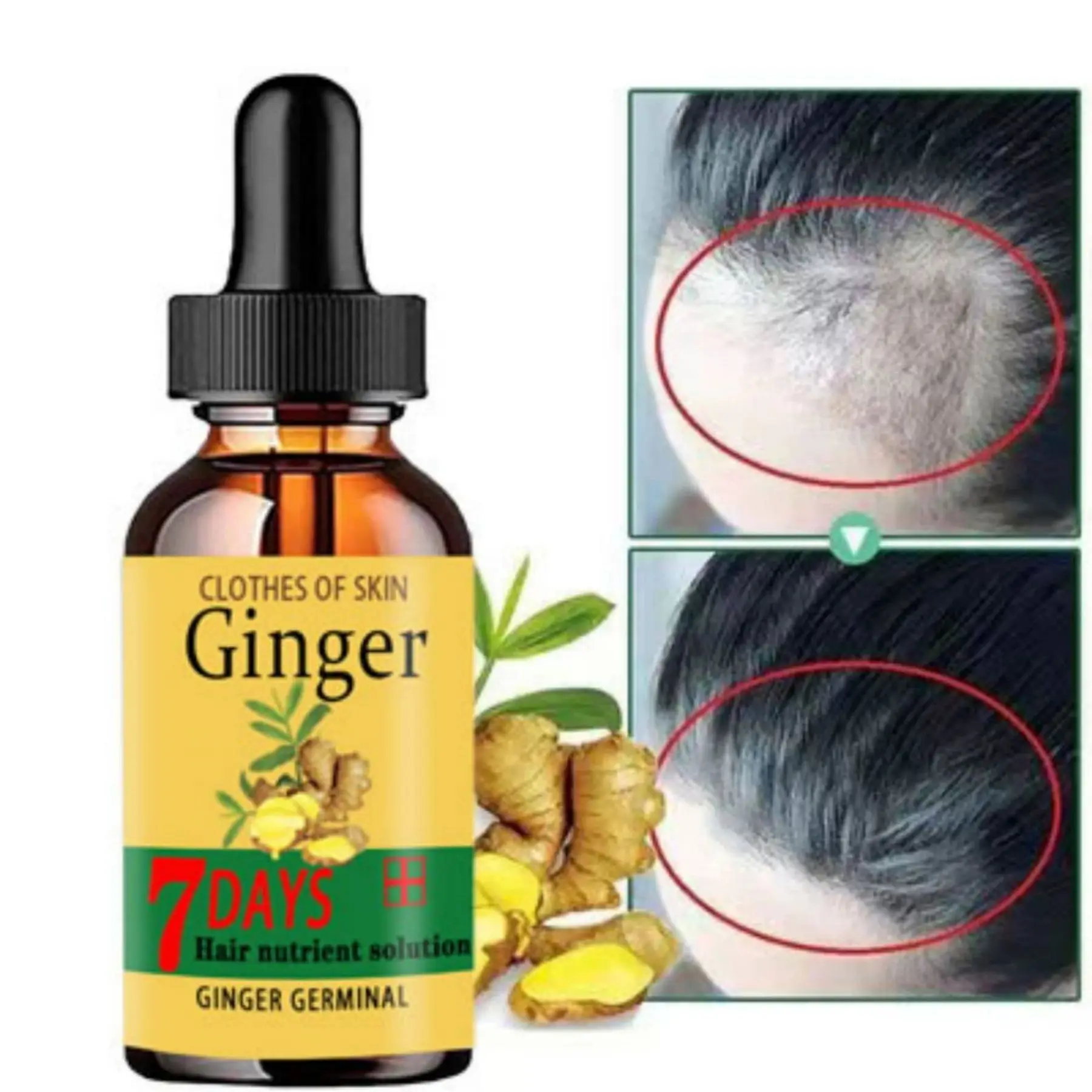 Aceite de esencia de crecimiento del cabello de jengibre, suero para el crecimiento del cabello, Spray Anti pérdida de cabello, tratamiento pampakapal ng buhok