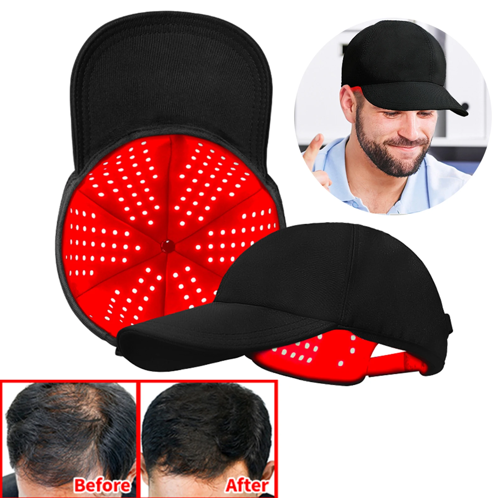 Thumbnail 3 - #5 Compare Light Therapy Lamps Before You Buy