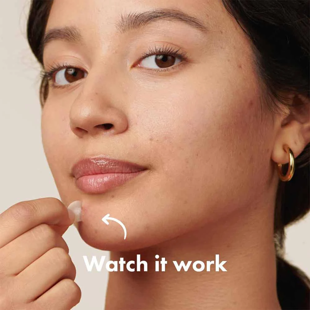 Hydrogel Acne Patch Invisible Closed Mouth Invisible Acne Face Invisible Waterproof and Breathable Skin Patch Skin Care Tools