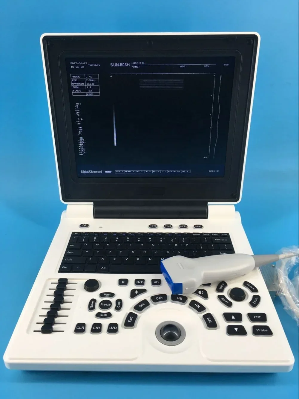 CE Cheap Ecograph Laptop Portable Black and White Ultrasound Machine