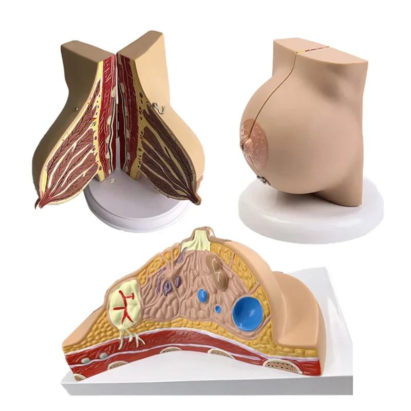 Breast Lesion Model Human Female Quiescent Breast Anatomy Model Environmentally Friendly Medical Teaching Display Model