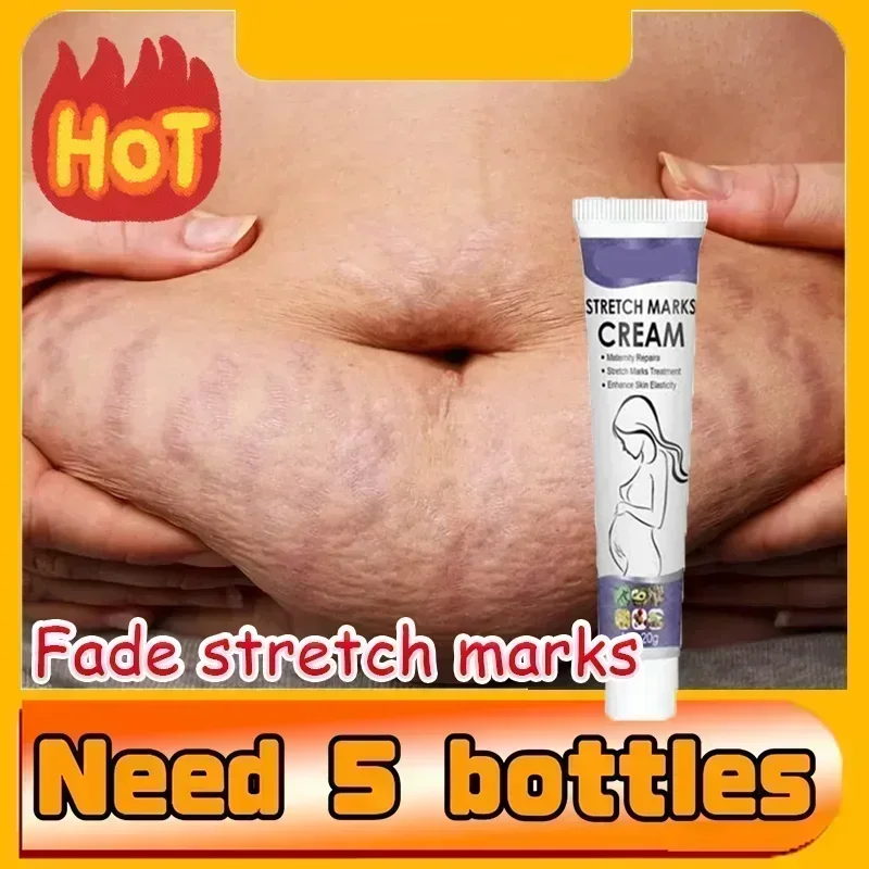 HOT~Eliminate Red White Old Stretch Marks Cream For Pregnancy Postpartum Skin Care Gel