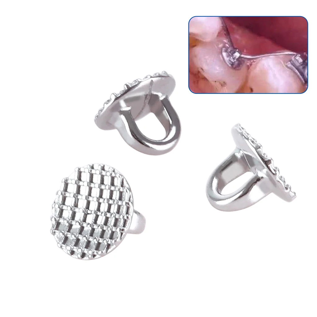 50 Stück/Box AZDENT Dental-Kieferorthopädische Lingual-Knöpfe mit Loch, klebbare runde Basis, Zahnmedizinmaterial aus Edelstahl – Detail 10