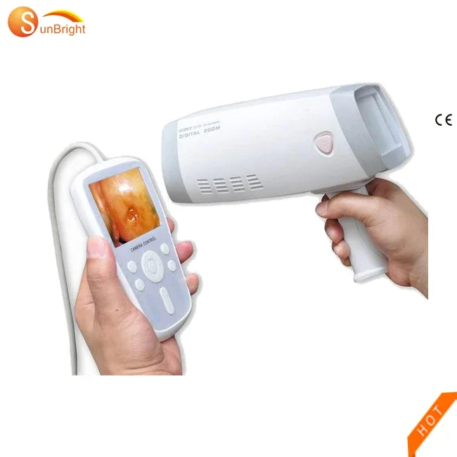 Handheld Gynecology Colposcopy system digital electronic video  for gynecology