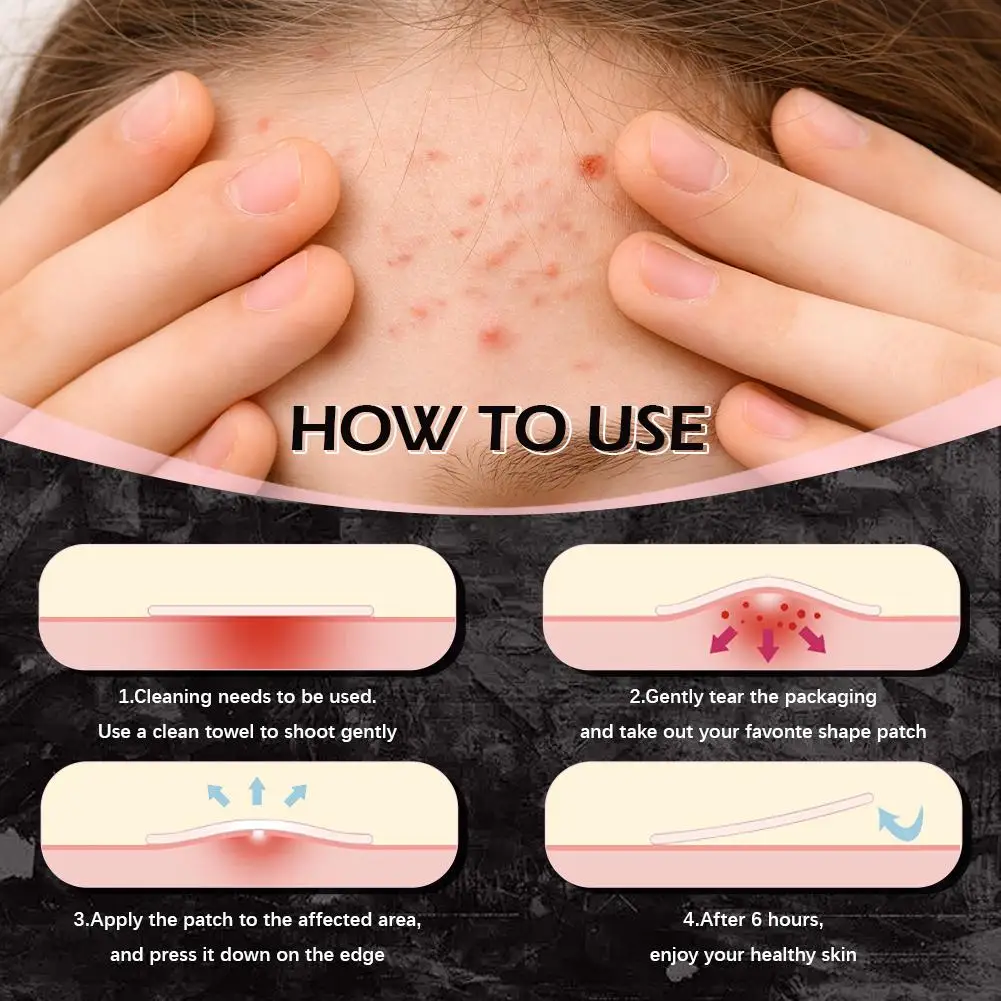 Ensemble de patchs d'acné en forme d'étoile noir et rose, 220 pièces, Style doux et Cool Y2K PE correcteur de boutons, estompe les marques d'acné, accessoire de soins du visage