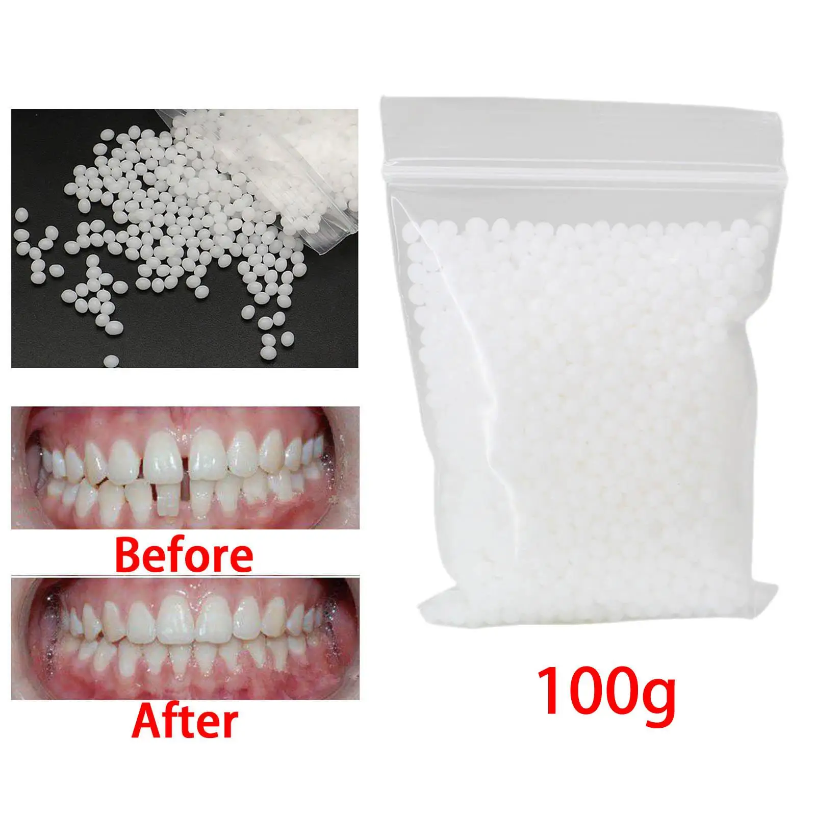 100G Temporary Tooth Repair Kit Temporary Tooth Fix for Fake Veneer