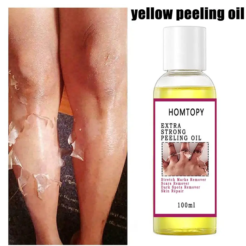 Yellow Peeling Oil Dark Skin Bleaching Remove Arm Knee Whitening Serum Skin Legs Scrub Lightening Exfoliating Dead Body B6T4