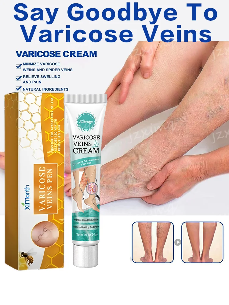 

VARICOSSE Cream Laser