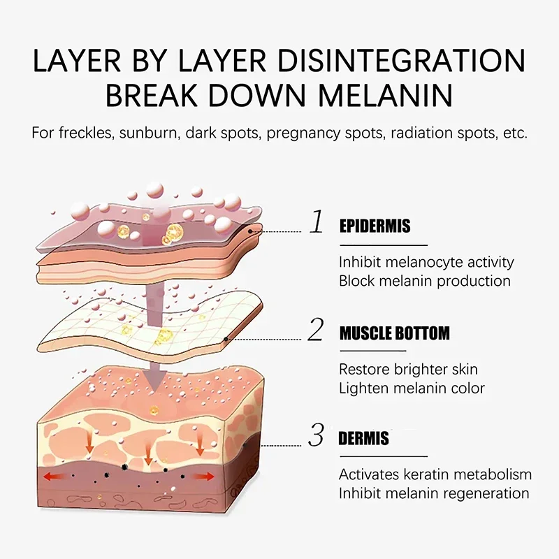 Remoção de melanina equilíbrio da pele soro manchas escuras removedor sarda clareamento umidade poderosa remoção ponto preto melasma cloasma