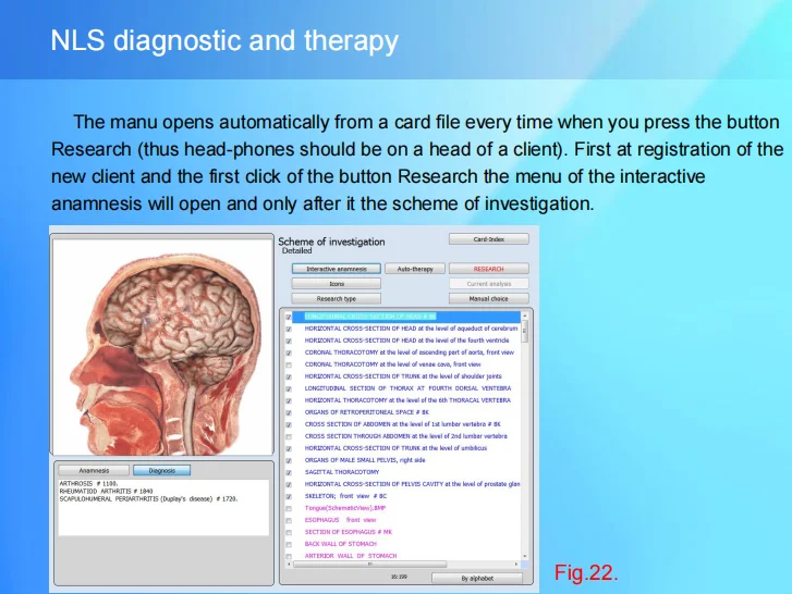 9D NLS Bioresonance Machine Meta Therapy Vegeto Reprinter Vera-Test Spectrum Etalon-Object CELL Diagnostics Sub Body Health