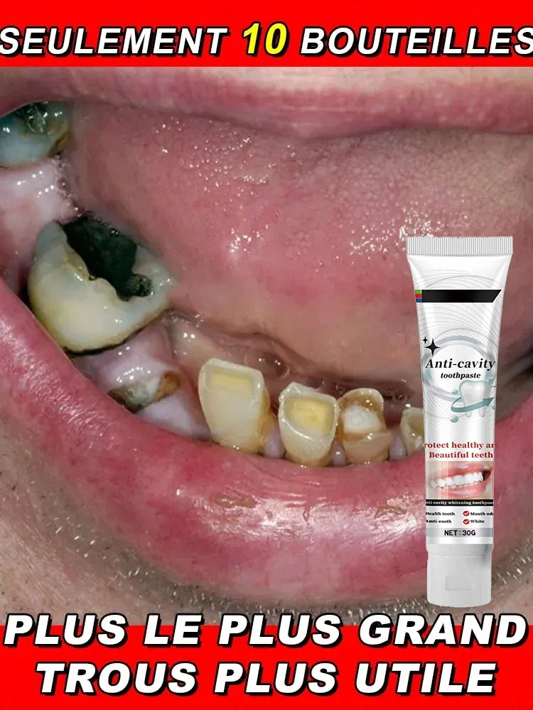 

Use natural plant extracts to repair tooth decay, whiten teeth, and remove tooth decay