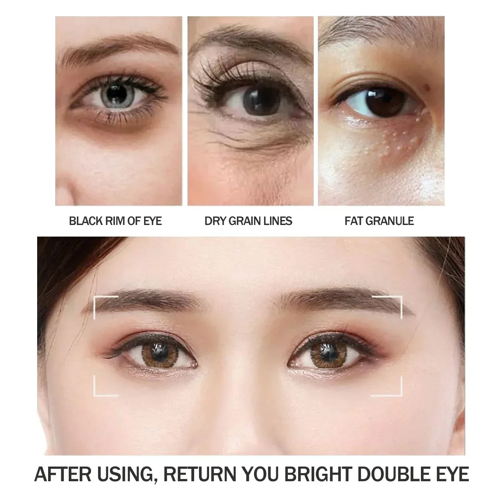 Remove Dark Circles Eye Cream Anti-Wrinkle Fade Fine Lines Anti Eye Bags Puffiness Lift Firming Moisturizing Brighten Eye Care