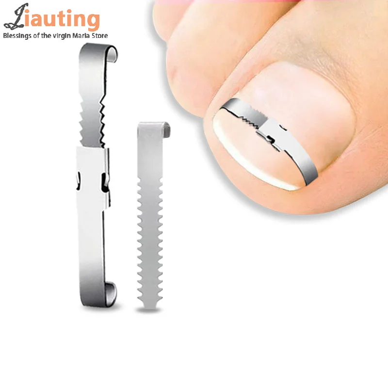 Ingrown Toenail Corrector Tools Pedicure Recover Embed Toe Nail Treatment Professional Ingrown Toenail Correction Foot CareTool