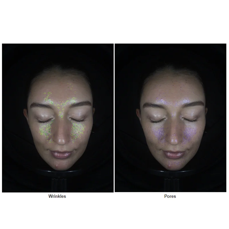 Pele Facial Detectar Máquina, Scanner 3D para Salão De Beleza