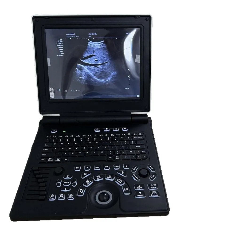 Pasture Portable Color Ultrasound Diagnostic Instrument 12-inch Veterinary Color Ultrasound Machine