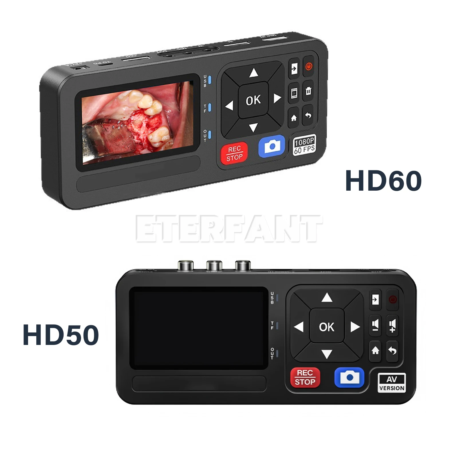 

ETERFANT Portable Medical Surgical Recorder for Laparoscopy and Endoscopy Capture HD50/HD60