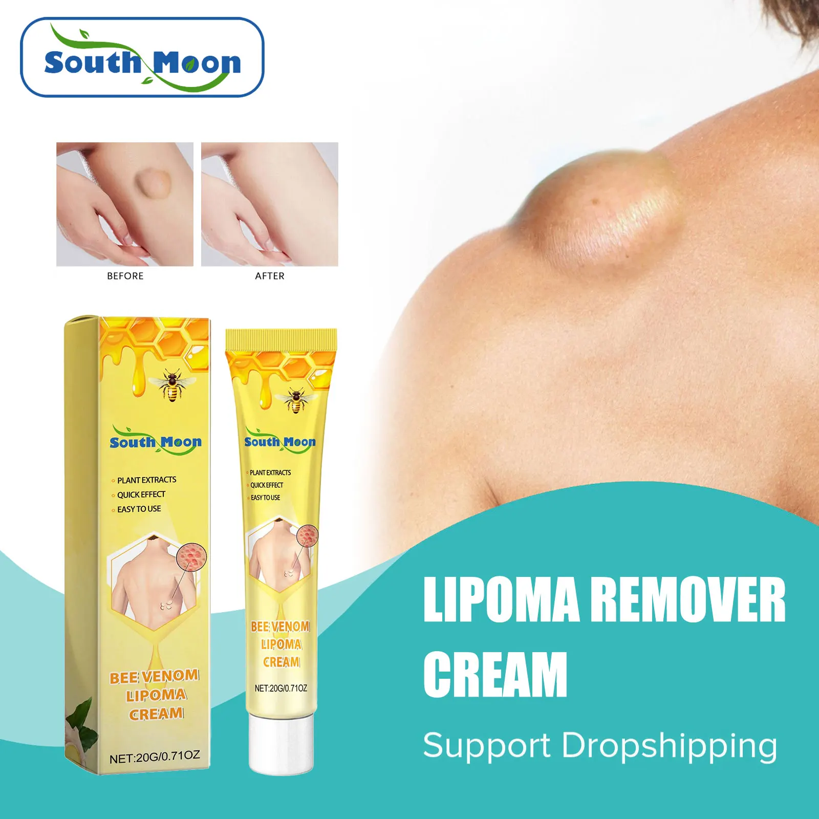 Bee Venom Lipoma Removal Cream Lymphatic Detox Health Care Anti Swelling Neck Armpit Breast Skin Lymph Node Treatment Ointment