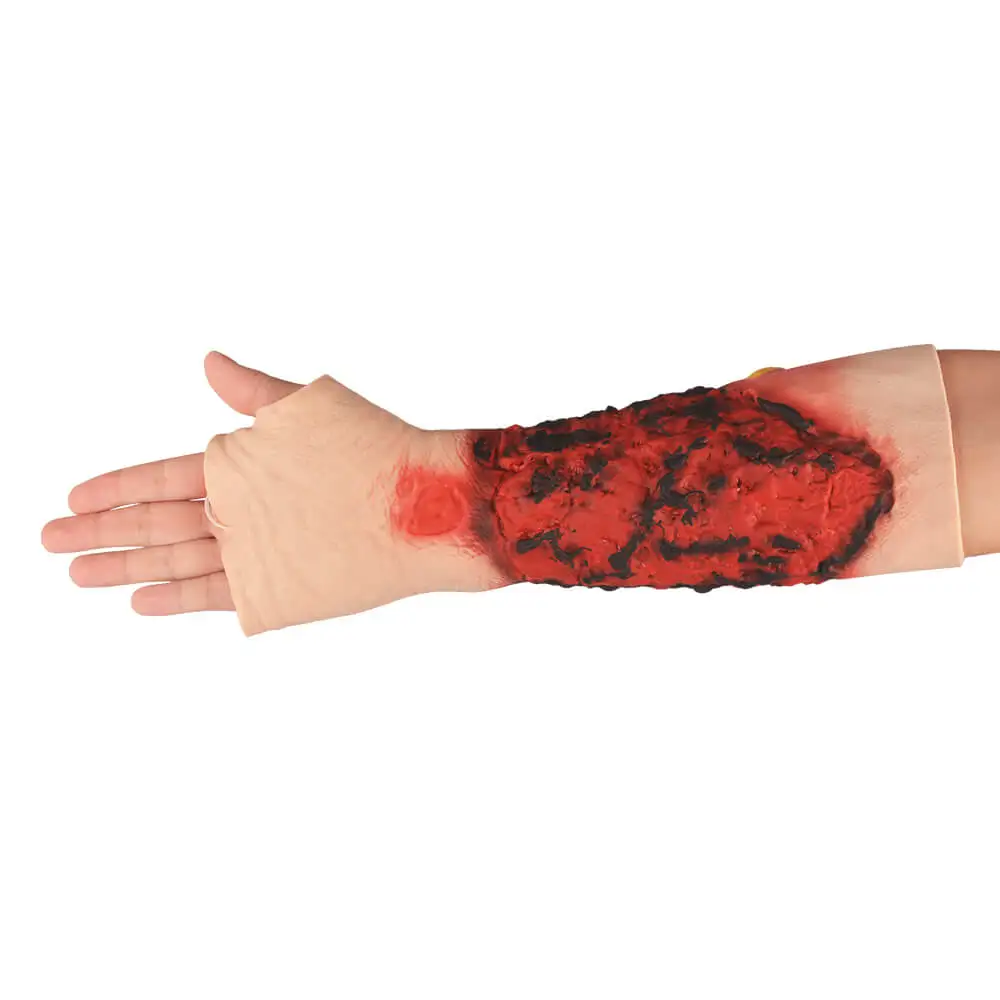 

3rd Degree Forearm Burn Simulation Sleeve