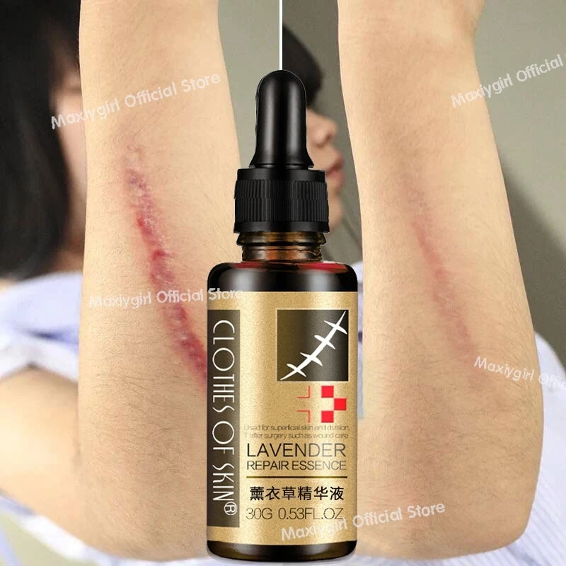 Natural Pure Repair Skin Lavender Skin Care Essential Oil 30g