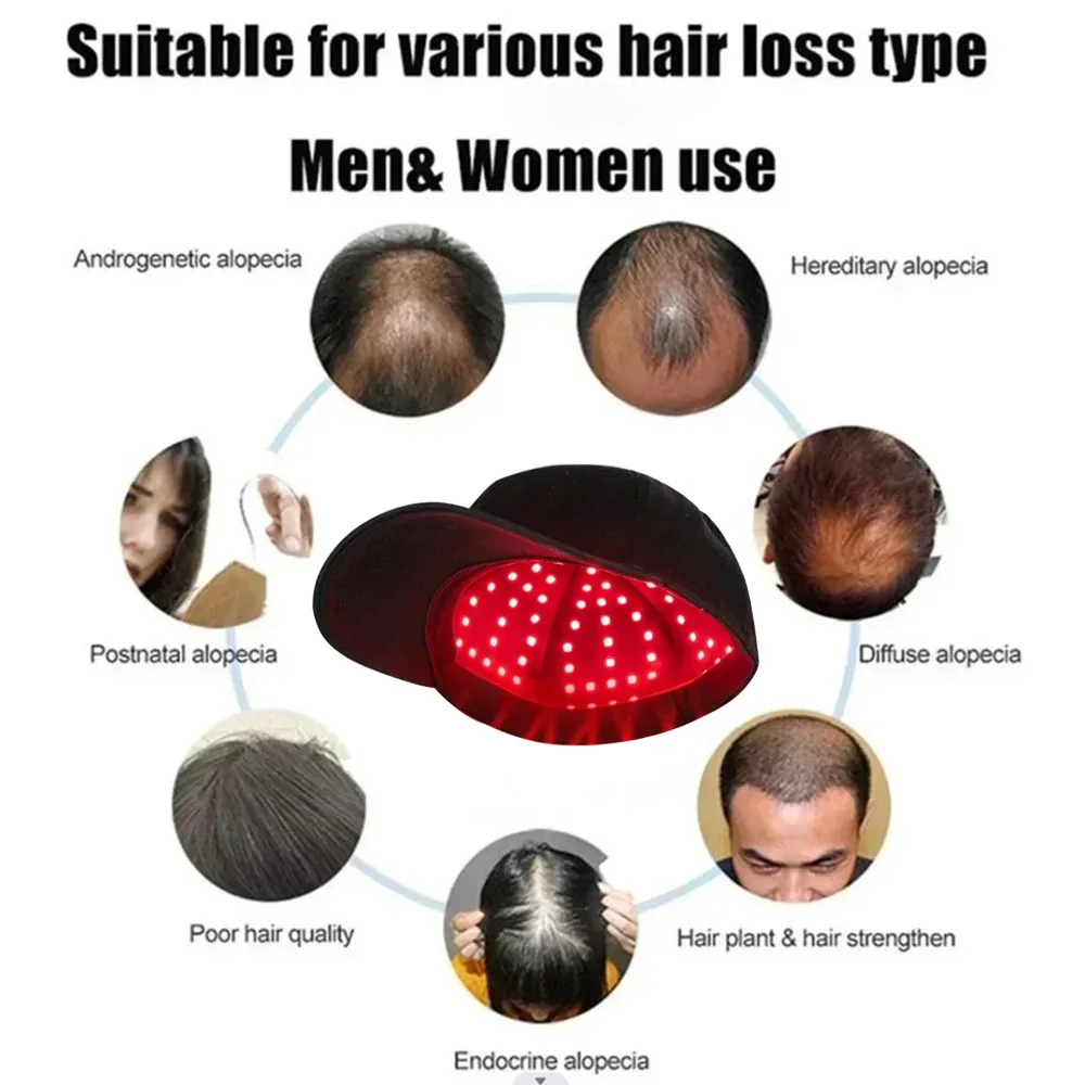 Topi Laser pertumbuhan rambut Led, perawatan rambut rontok profesional topi perawatan lampu merah