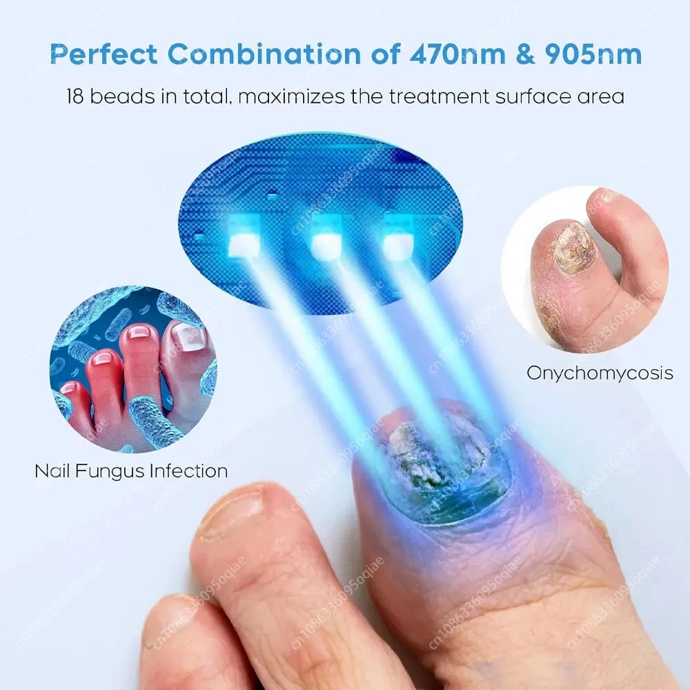 Nail Fungus Laser Device Fungal Nail Treatment Repair Onychomycosis Toenail Fingernail Removes Pedicure Foot Care Fungi Ingrown