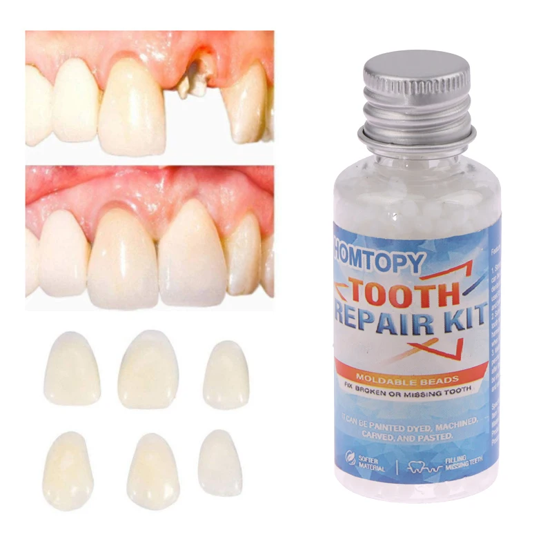 30ml Resin Tooth Repair Glue Shapeable Teeth Gaps Filling Solid Temporary Teeth Repair False Teeth Glue Safety Dental Supplies