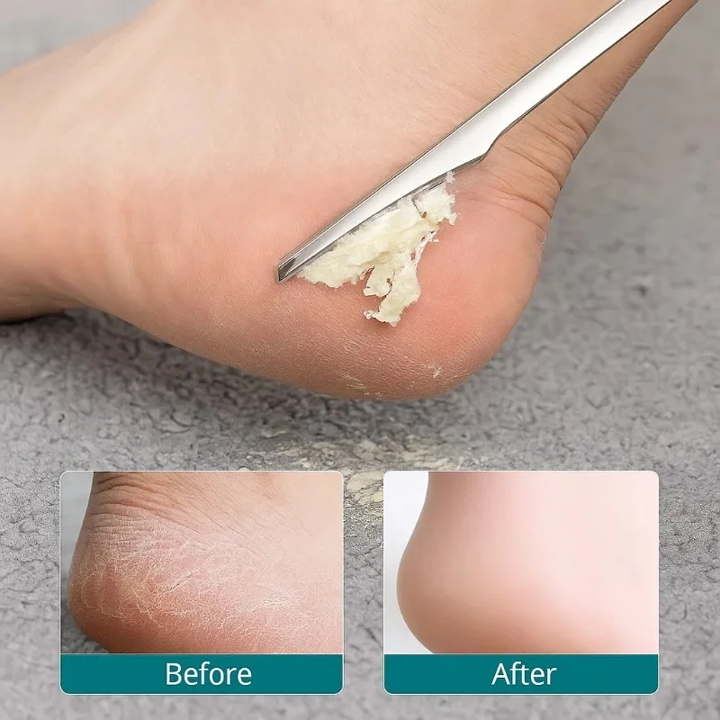 Professional 1 2 5PCS Foot Callus Remover Pedicure Knife Set Dead Skin Scraper Toe Nail Shaver Manicure Pedicure Tool for Nail C