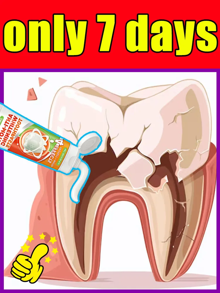 

Не отправляйте небольшие полости становится большими проблемами. Зубная паста, которая может точно восстанавливать полость.