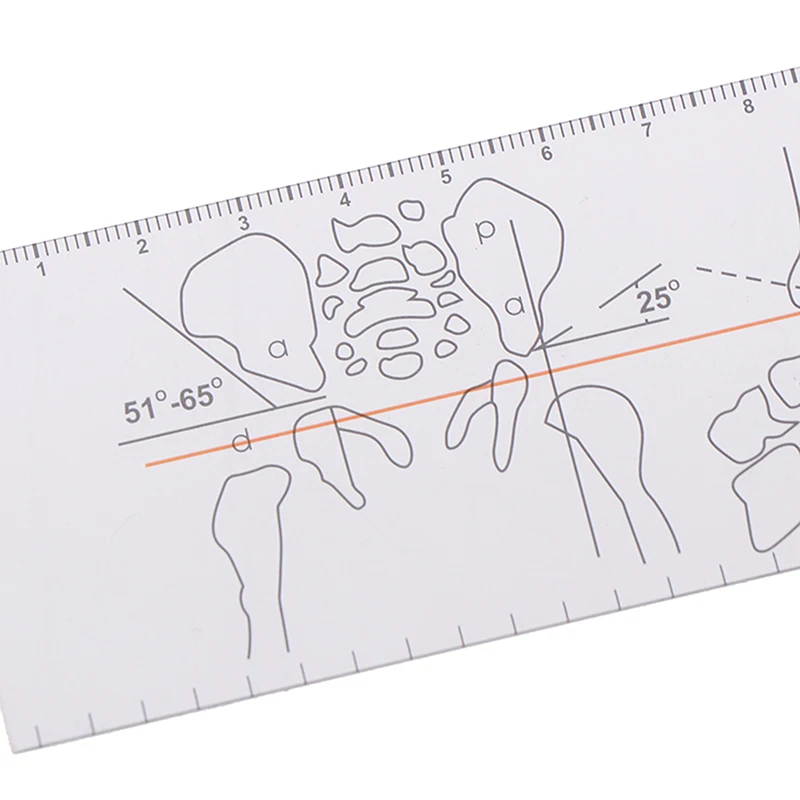 Goniômetro de plástico ângulo régua regra comum ortopedia instrumentos ferramenta médica ângulo espinhal régua ângulo localizador ferramenta de