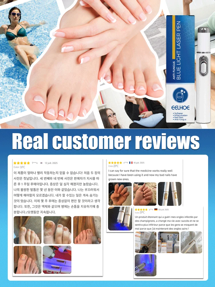 Nagelbürste Blaulicht-Laserwerkzeuge der zweiten Generation