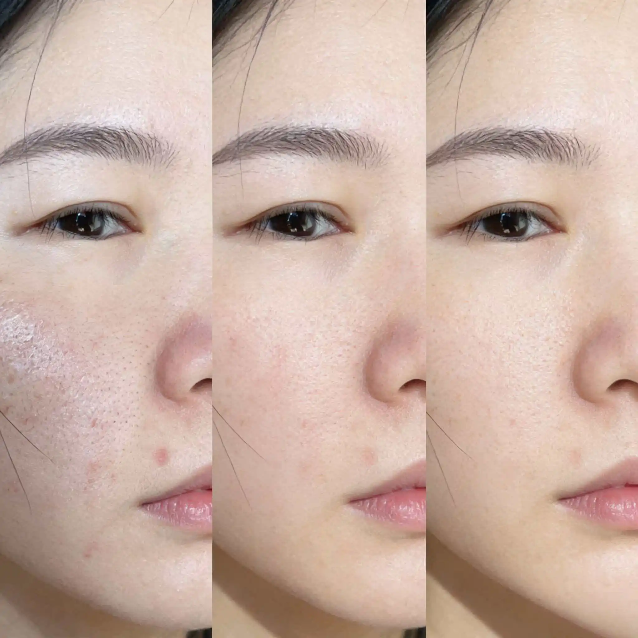 makeup tools peel glycolic acid original pure ordinary solution 20%-70% peel aha 5ml (10-Piece Set) for a cleaner