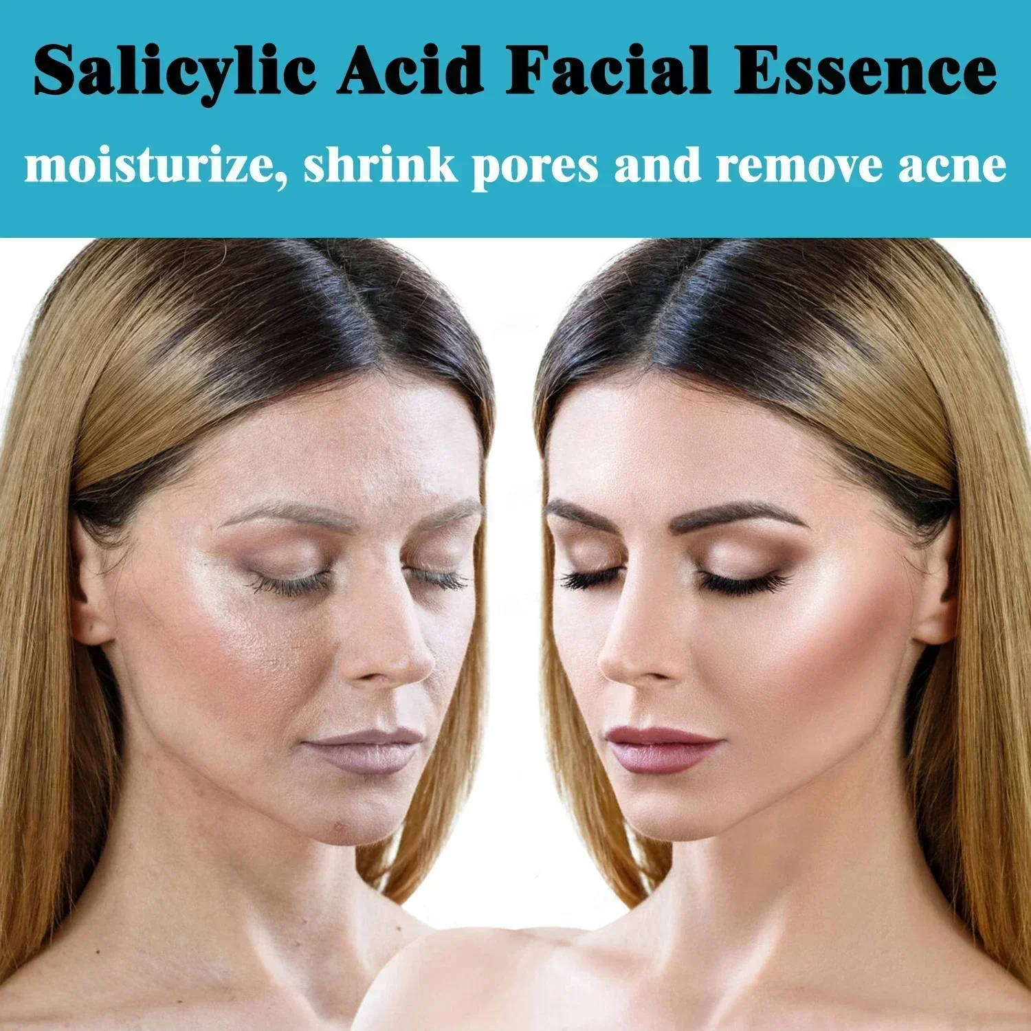 Ácido salicílico Soro facial esfoliante, Hidratante facial, Limpeza profunda, Hidratante facial, Controle de óleo, Essência, Cuidados com a pele coreanos