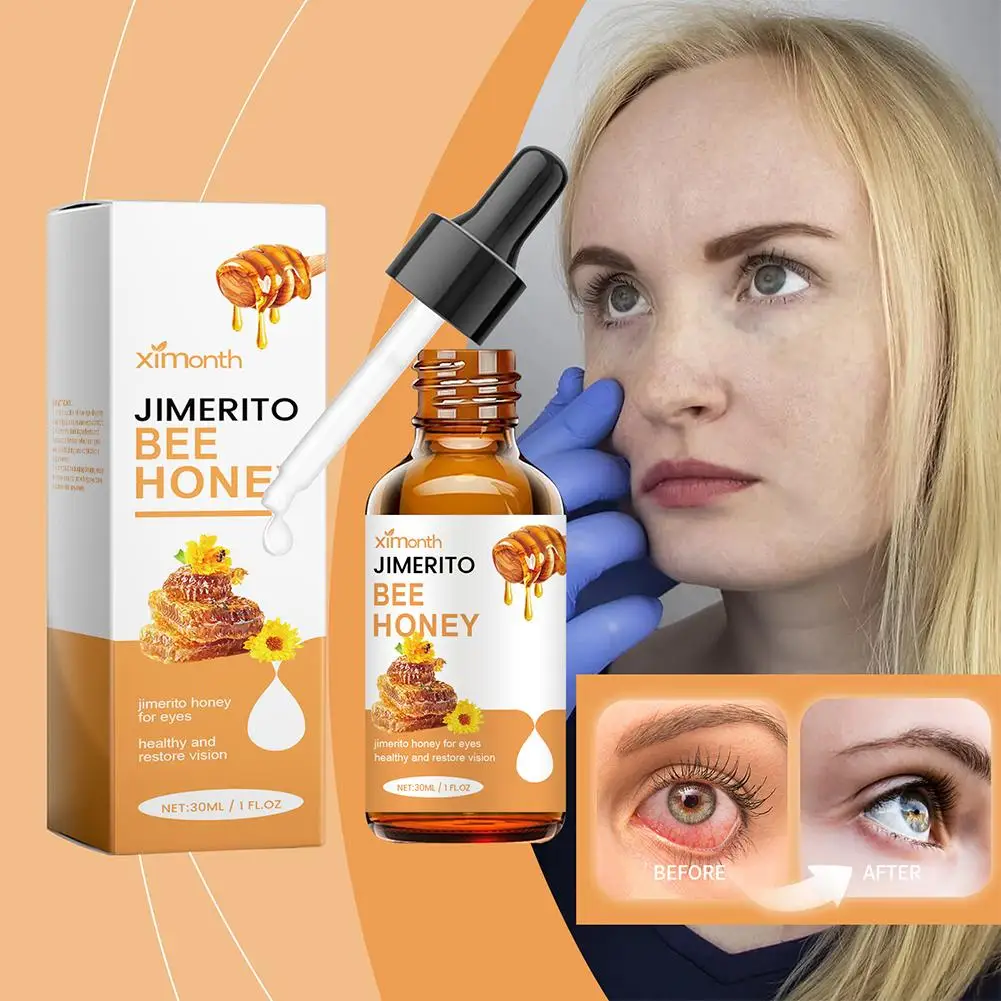 Honey Eye Drops Dry Eye Symptom Reliever Drop Multi-symptom Eye Care Products For Fatigue Dry Eyes Blurred Vision 30ml