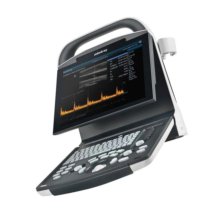 CE Best Price Clinic Hospital laptop mindray ultrasound B/W display ultrasound machine price