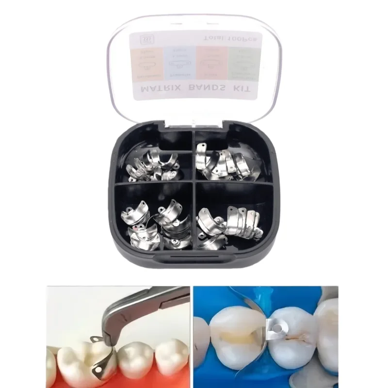 100 قطعة/صندوق M4 الأسنان المعادن مصفوفة الفرقة احيط الاقسام نظام مصفوفة لاستعادة الأسنان أدوات طب الأسنان 3.5/4.5/5.5/6.5 مللي متر