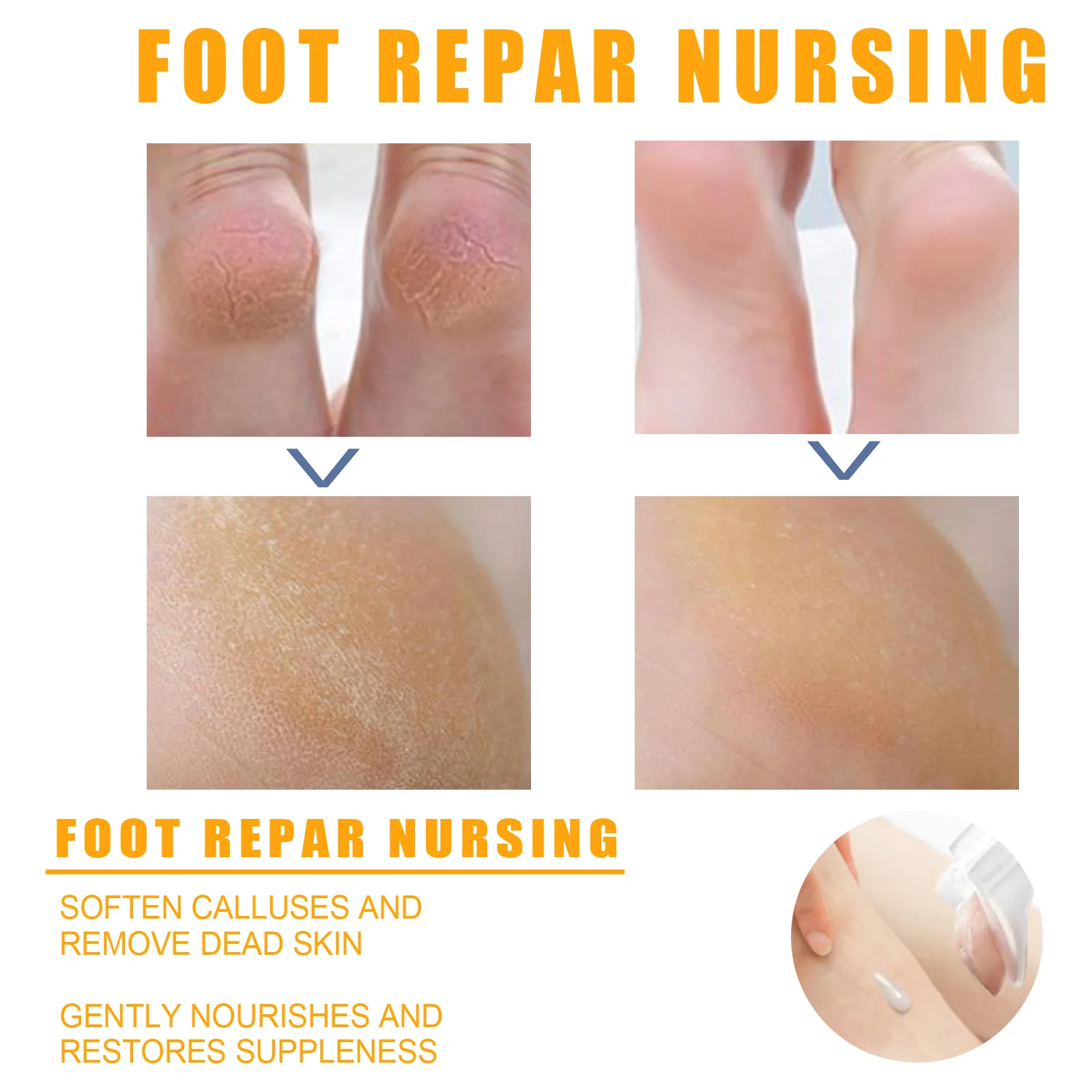 YanSuYing7 Seconds Foot Exfoliator Softener Removes Dead Skin and Calluses Foot Mask Anti Crack Heel Nail Pedicure Set