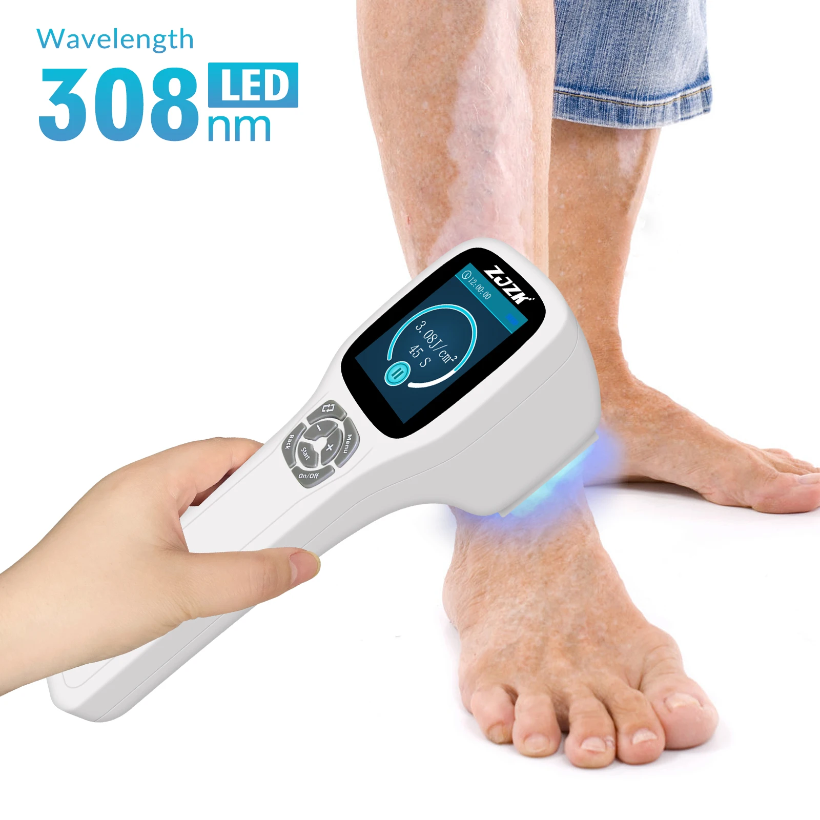 

ZJZK New Handheld Led Light Source Excimer 308nm Laser Vitiligo Physical Therapy Reduce White Spots on Body Back Hands Legs Neck